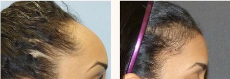 феминизация