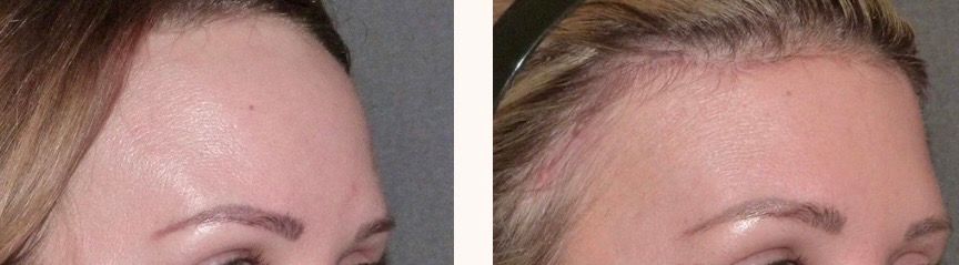 феминизация