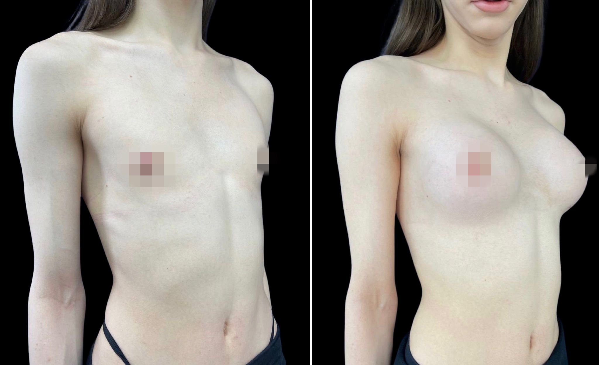 феминизация