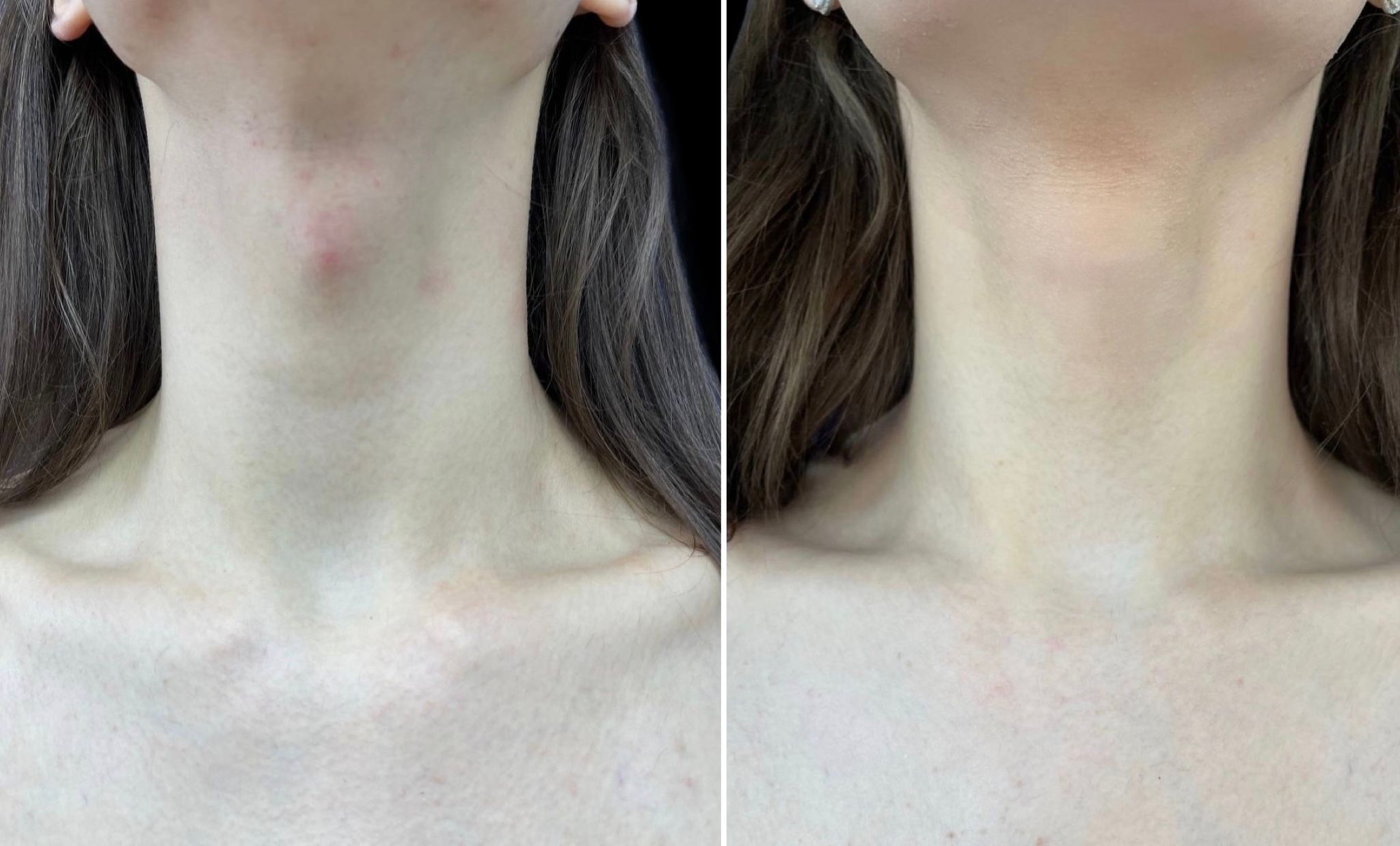 феминизация