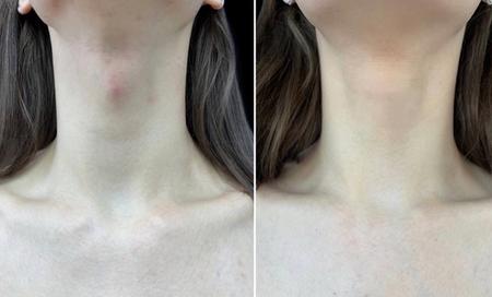 феминизация