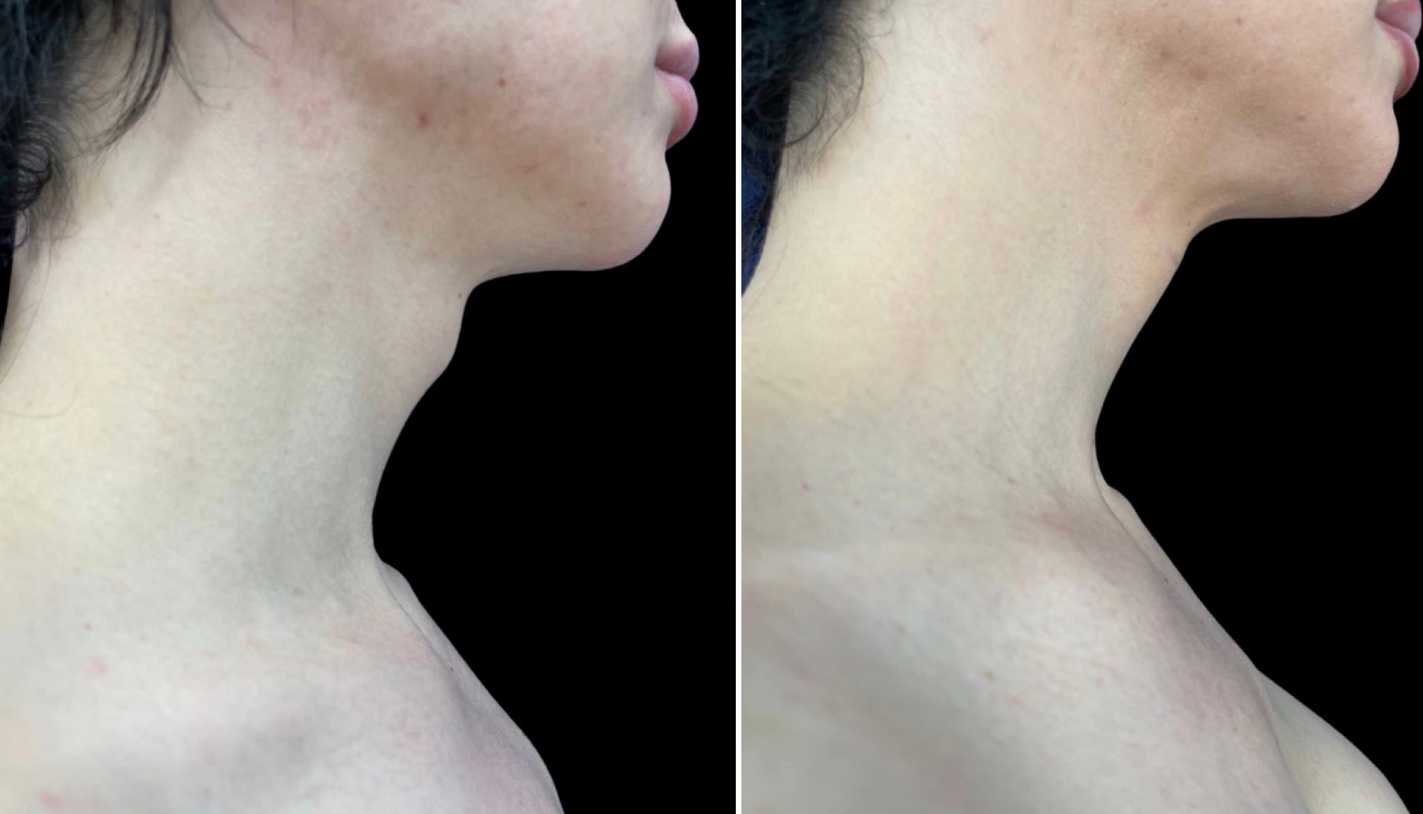 феминизация