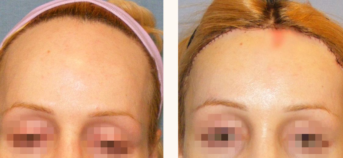 феминизация