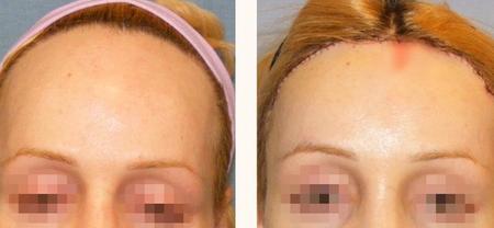 феминизация