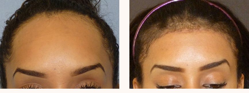  феминизация