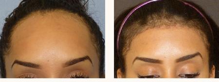 феминизация