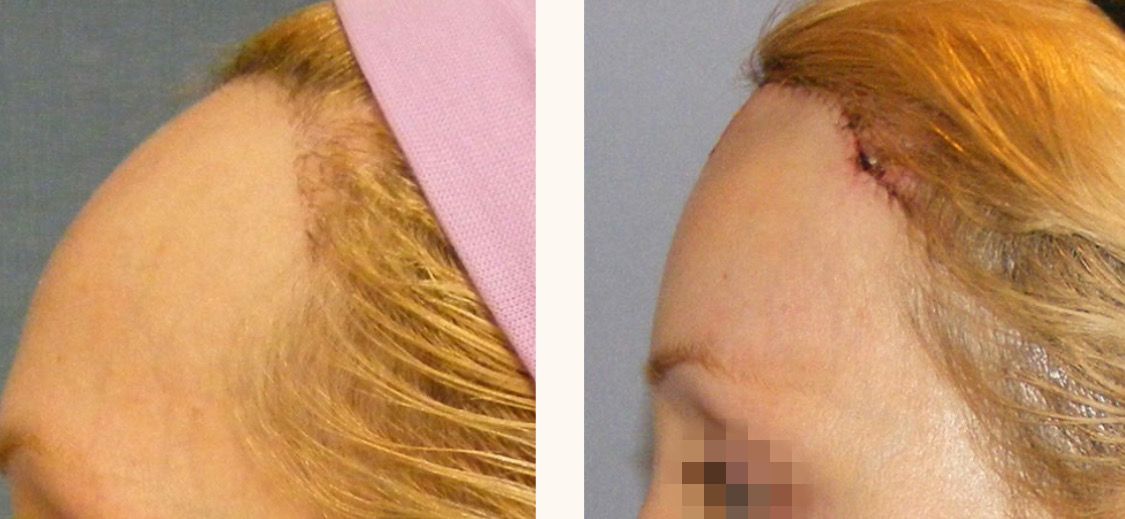 феминизация