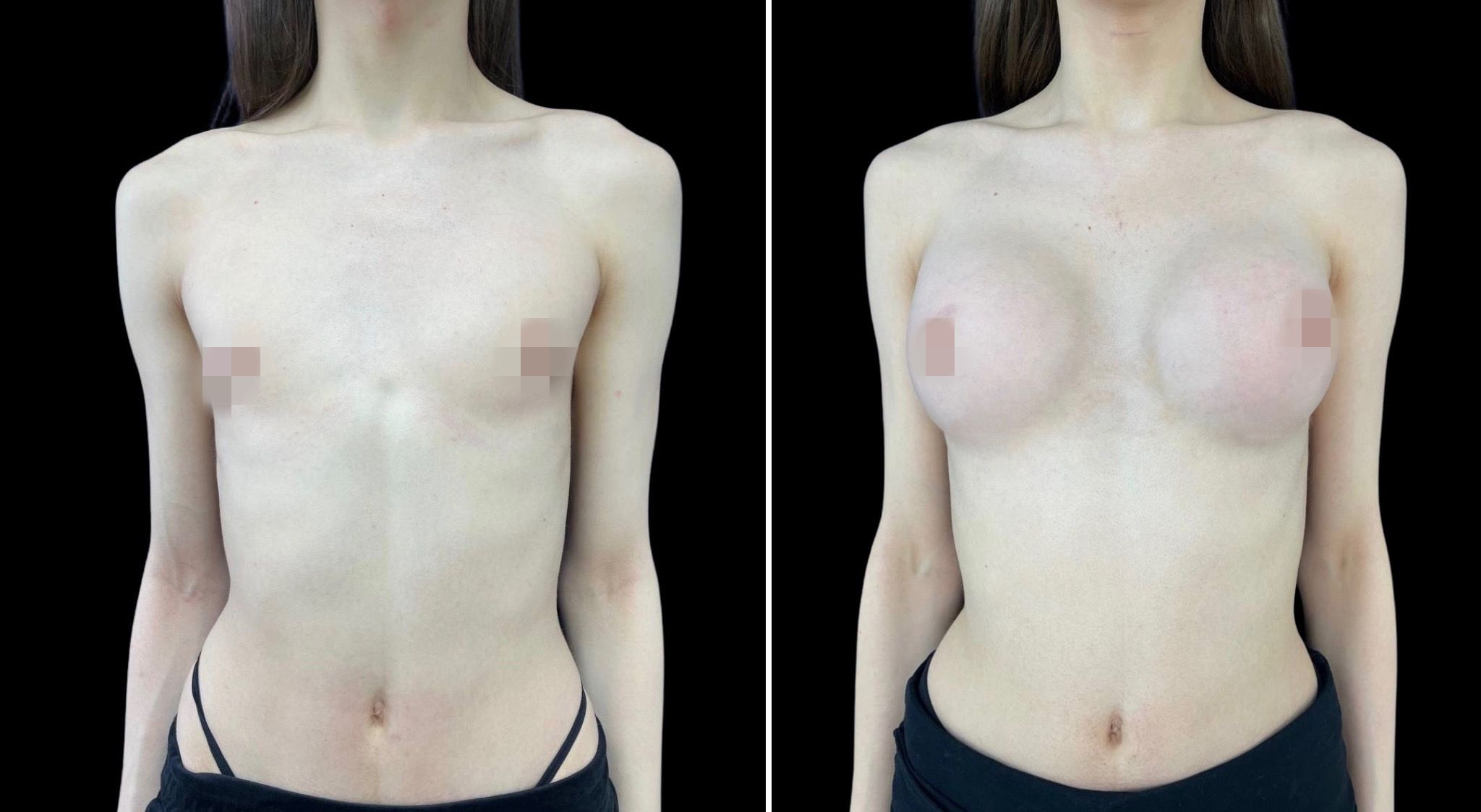 феминизация