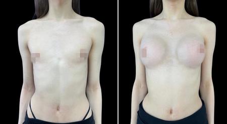 феминизация