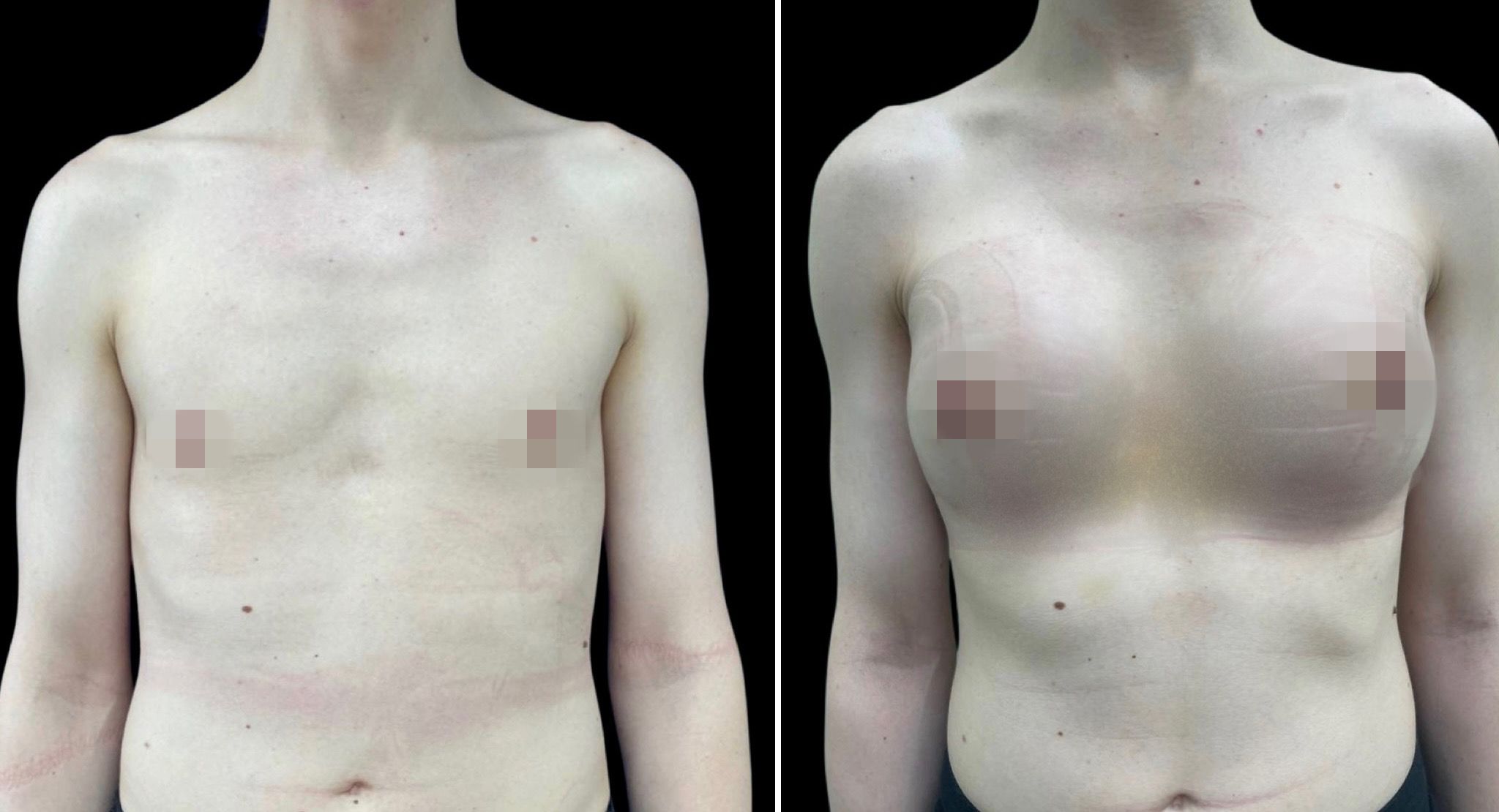 феминизация