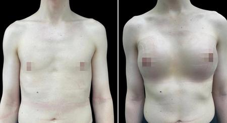 феминизация