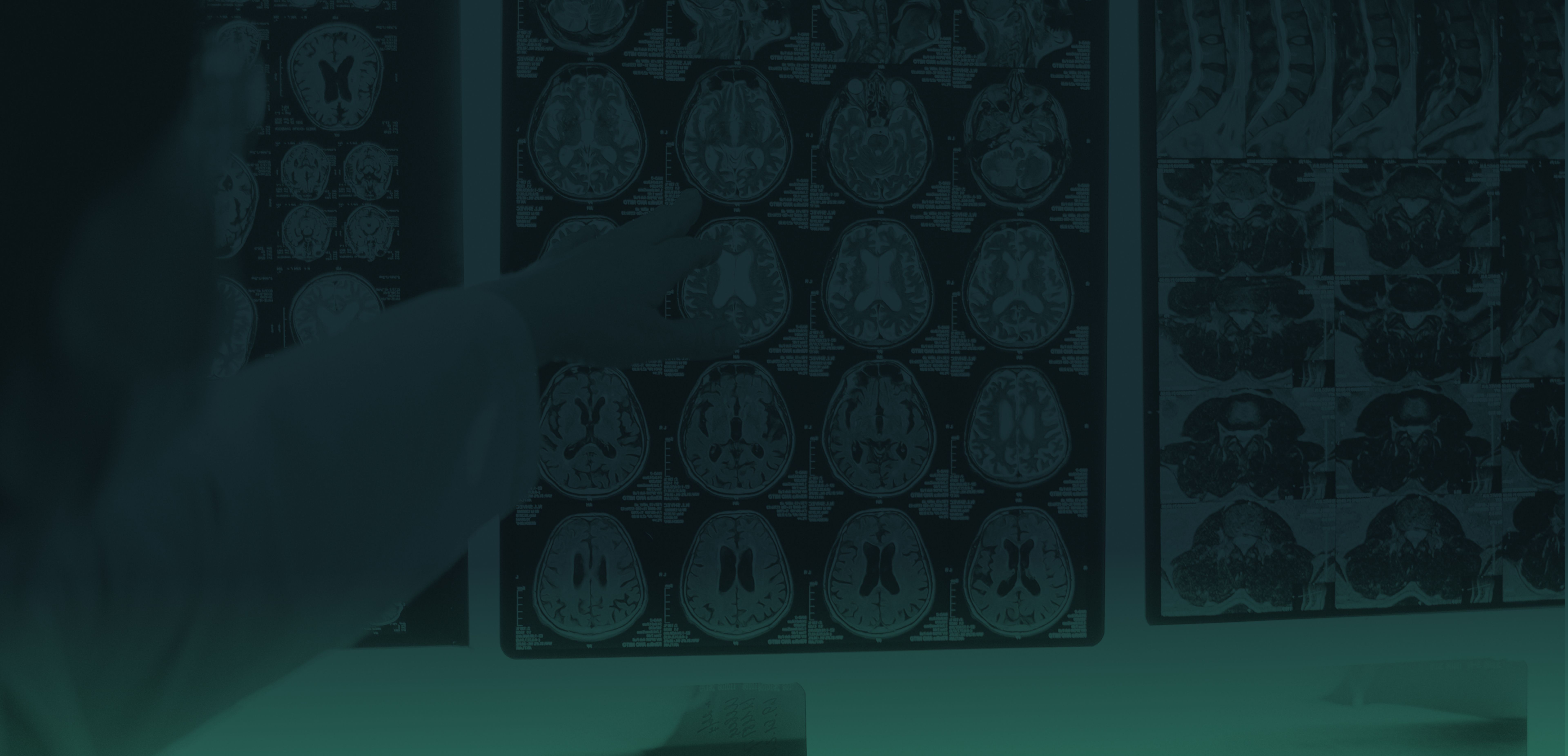 Background image of doctor pointing at MRI