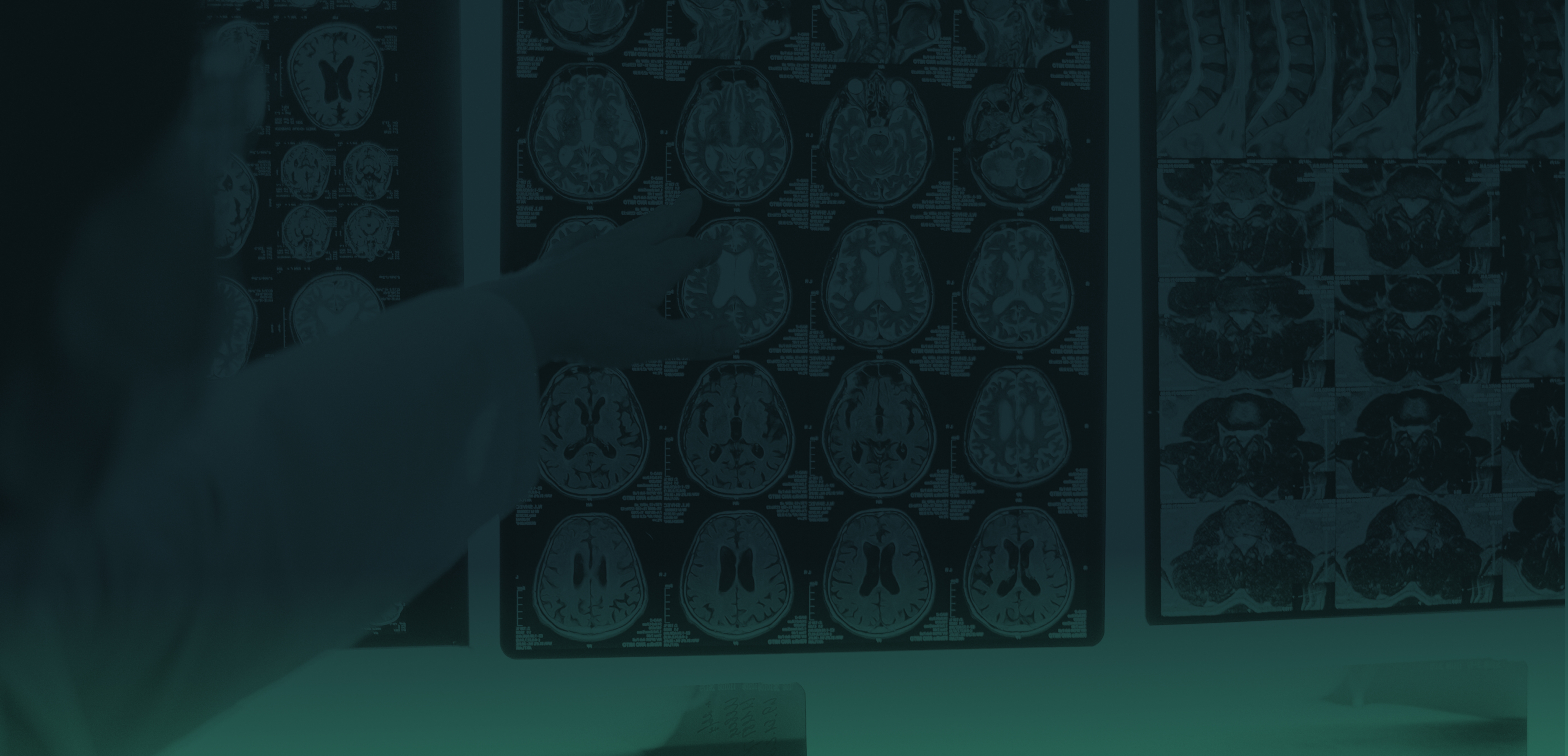 Background image of doctor pointing at MRI