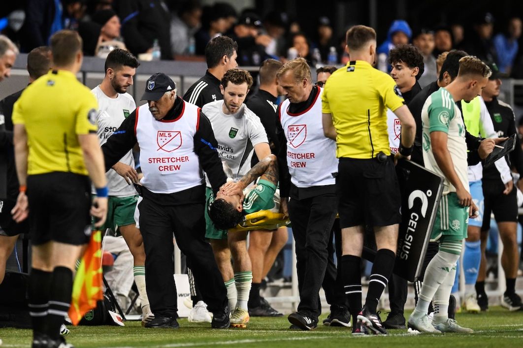 The 26-year-old Vazquez – once an Open Cup Champ with Atlanta United – carried off the field in San Jose ​​​​‌﻿‍﻿​‍​‍‌‍﻿﻿‌﻿​‍‌‍‍‌‌‍‌﻿‌‍‍‌‌‍﻿‍​‍​‍​﻿‍‍​‍​‍‌﻿​﻿‌‍​‌‌‍﻿‍‌‍‍‌‌﻿‌​‌﻿‍‌​‍﻿‍‌‍‍‌‌‍﻿﻿​‍​‍​‍﻿​​‍​‍‌‍‍​‌﻿​‍‌‍‌‌‌‍‌‍​‍​‍​﻿‍‍​‍​‍‌‍‍​‌﻿‌​‌﻿‌​‌﻿​​‌﻿​﻿​﻿‍‍​‍﻿﻿​‍﻿﻿‌﻿‌‌‌﻿​﻿‌﻿​﻿‌‍‌‍​‍﻿‍‌﻿​﻿‌‍​‌‌‍﻿‍‌‍‍‌‌﻿‌​‌﻿‍‌​‍﻿‍‌﻿​﻿‌﻿‌​‌﻿‌‌‌‍‌​‌‍‍‌‌‍﻿﻿​‍﻿﻿‌‍‍‌‌‍﻿‍‌﻿‌​‌‍‌‌‌‍﻿‍‌﻿‌​​‍﻿﻿‌‍‌‌‌‍‌​‌‍‍‌‌﻿‌​​‍﻿﻿‌‍﻿‌‌‍﻿﻿‌‍‌​‌‍‌‌​﻿﻿‌‌﻿​​‌﻿​‍‌‍‌‌‌﻿​﻿‌‍‌‌‌‍﻿‍‌﻿‌​‌‍​‌‌﻿‌​‌‍‍‌‌‍﻿﻿‌‍﻿‍​﻿‍﻿‌‍‍‌‌‍‌​​﻿﻿‌​﻿‌‌‌‍​‍​﻿‌‌​﻿‍‌‌‍​﻿​﻿‌‌​﻿​‍‌‍‌‌​‍﻿‌‌‍‌‌​﻿​​​﻿​﻿​﻿‌‌​‍﻿‌​﻿‌​​﻿​​‌‍‌‍‌‍​‌​‍﻿‌​﻿‍‌​﻿‍‌​﻿‌‍​﻿‌‍​‍﻿‌‌‍‌‍​﻿​﻿‌‍​‍​﻿‍‌​﻿‌﻿‌‍‌​‌‍‌‌​﻿‌​​﻿‌​​﻿‌‌​﻿‌‌‌‍​‍​﻿‍﻿‌﻿‌​‌﻿‍‌‌﻿​​‌‍‌‌​﻿﻿‌‌﻿​﻿‌﻿‌​‌‍﻿﻿‌﻿​‍‌﻿‍‌​﻿‍﻿‌﻿​​‌‍​‌‌﻿‌​‌‍‍​​﻿﻿‌‌‍​﻿‌‍﻿﻿‌‍﻿‍‌﻿‌​‌‍‌‌‌‍﻿‍‌﻿‌​​‍‌‌​﻿‌‌‌​​‍‌‌﻿﻿‌‍‍﻿‌‍‌‌‌﻿‍‌​‍‌‌​﻿​﻿‌​‌​​‍‌‌​﻿​﻿‌​‌​​‍‌‌​﻿​‍​﻿​‍‌‍​﻿‌‍​‌​﻿‌‌​﻿​‌​﻿‌﻿​﻿‌‍​﻿​‍​﻿‍‌​﻿​﻿​﻿‌﻿​﻿‌​​﻿​‌​‍‌‌​﻿​‍​﻿​‍​‍‌‌​﻿‌‌‌​‌​​‍﻿‍‌‍‍‌‌‍﻿‌‌‍​‌‌‍‌﻿‌‍‌‌​‍﻿‍‌‍​‌‌‍﻿​‌﻿‌​​﻿﻿﻿‌‍​‍‌‍​‌‌﻿​﻿‌‍‌‌‌‌‌‌‌﻿​‍‌‍﻿​​﻿﻿‌‌‍‍​‌﻿‌​‌﻿‌​‌﻿​​‌﻿​﻿​‍‌‌​﻿​﻿‌​​‌​‍‌‌​﻿​‍‌​‌‍​‍‌‌​﻿​‍‌​‌‍‌﻿‌‌‌﻿​﻿‌﻿​﻿‌‍‌‍​‍﻿‍‌﻿​﻿‌‍​‌‌‍﻿‍‌‍‍‌‌﻿‌​‌﻿‍‌​‍﻿‍‌﻿​﻿‌﻿‌​‌﻿‌‌‌‍‌​‌‍‍‌‌‍﻿﻿​‍‌‍‌‍‍‌‌‍‌​​﻿﻿‌​﻿‌‌‌‍​‍​﻿‌‌​﻿‍‌‌‍​﻿​﻿‌‌​﻿​‍‌‍‌‌​‍﻿‌‌‍‌‌​﻿​​​﻿​﻿​﻿‌‌​‍﻿‌​﻿‌​​﻿​​‌‍‌‍‌‍​‌​‍﻿‌​﻿‍‌​﻿‍‌​﻿‌‍​﻿‌‍​‍﻿‌‌‍‌‍​﻿​﻿‌‍​‍​﻿‍‌​﻿‌﻿‌‍‌​‌‍‌‌​﻿‌​​﻿‌​​﻿‌‌​﻿‌‌‌‍​‍​‍‌‍‌﻿‌​‌﻿‍‌‌﻿​​‌‍‌‌​﻿﻿‌‌﻿​﻿‌﻿‌​‌‍﻿﻿‌﻿​‍‌﻿‍‌​‍‌‍‌﻿​​‌‍​‌‌﻿‌​‌‍‍​​﻿﻿‌‌‍​﻿‌‍﻿﻿‌‍﻿‍‌﻿‌​‌‍‌‌‌‍﻿‍‌﻿‌​​‍‌‌​﻿‌‌‌​​‍‌‌﻿﻿‌‍‍﻿‌‍‌‌‌﻿‍‌​‍‌‌​﻿​﻿‌​‌​​‍‌‌​﻿​﻿‌​‌​​‍‌‌​﻿​‍​﻿​‍‌‍​﻿‌‍​‌​﻿‌‌​﻿​‌​﻿‌﻿​﻿‌‍​﻿​‍​﻿‍‌​﻿​﻿​﻿‌﻿​﻿‌​​﻿​‌​‍‌‌​﻿​‍​﻿​‍​‍‌‌​﻿‌‌‌​‌​​‍﻿‍‌‍‍‌‌‍﻿‌‌‍​‌‌‍‌﻿‌‍‌‌​‍﻿‍‌‍​‌‌‍﻿​‌﻿‌​​‍​‍‌﻿﻿‌