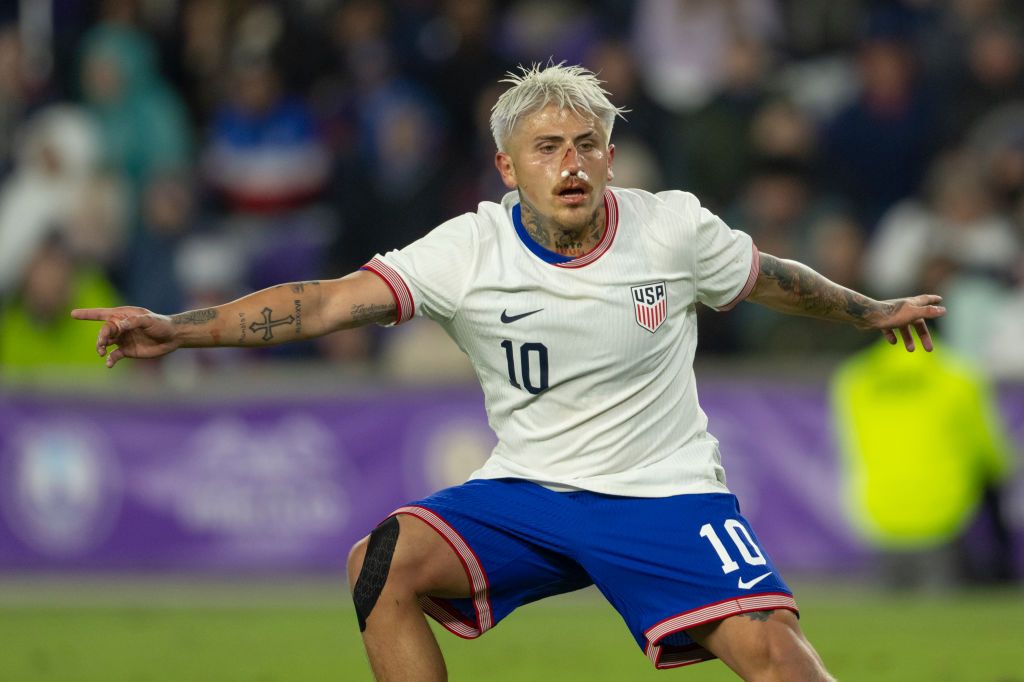 Diego Luna plays with broken nose