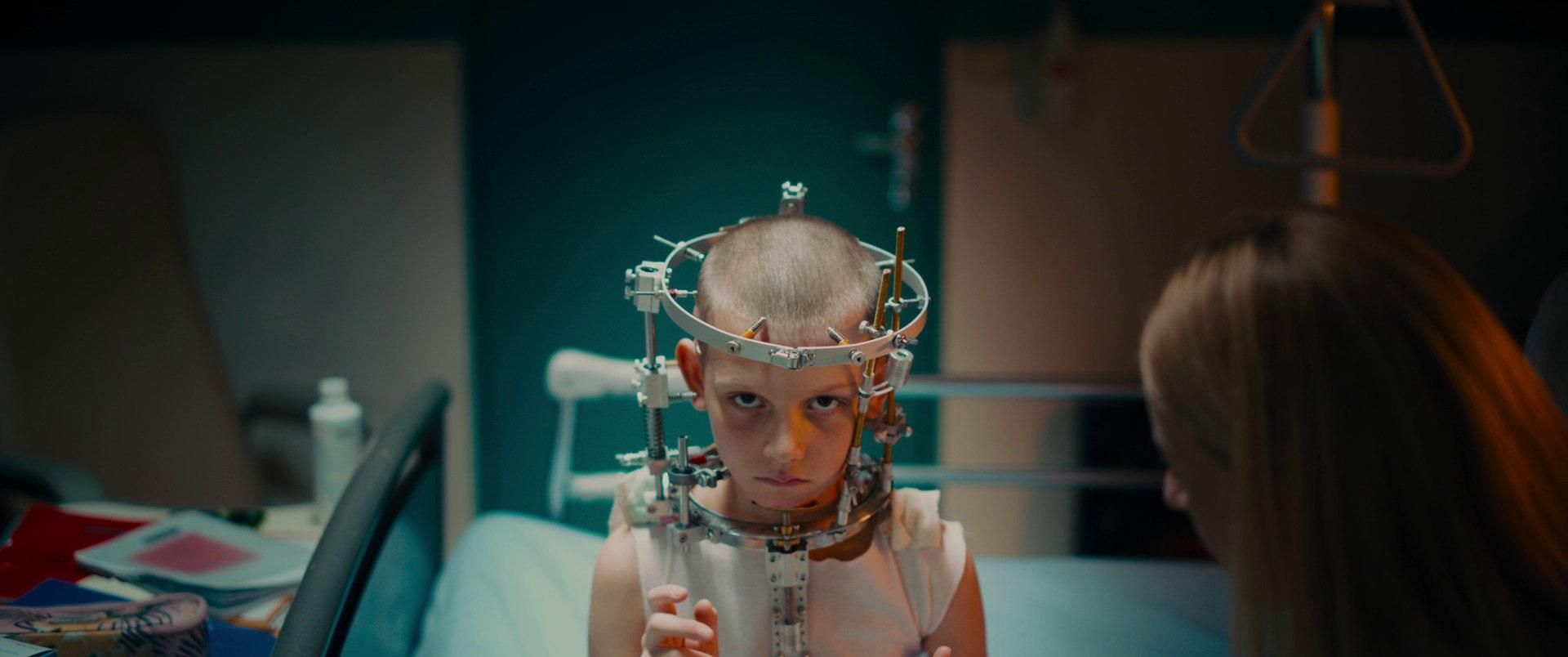 A young boy with a shaved head sits in a hospital bed, staring intensely at the camera while wearing a complex metal halo brace bolted into his skull. The lighting is clinical and moody, emphasizing the surgical hardware encircling his head.