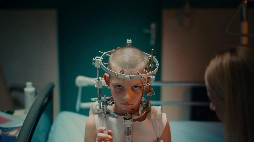 A young boy with a shaved head sits in a hospital bed, staring intensely at the camera while wearing a complex metal halo brace bolted into his skull. The lighting is clinical and moody, emphasizing the surgical hardware encircling his head.