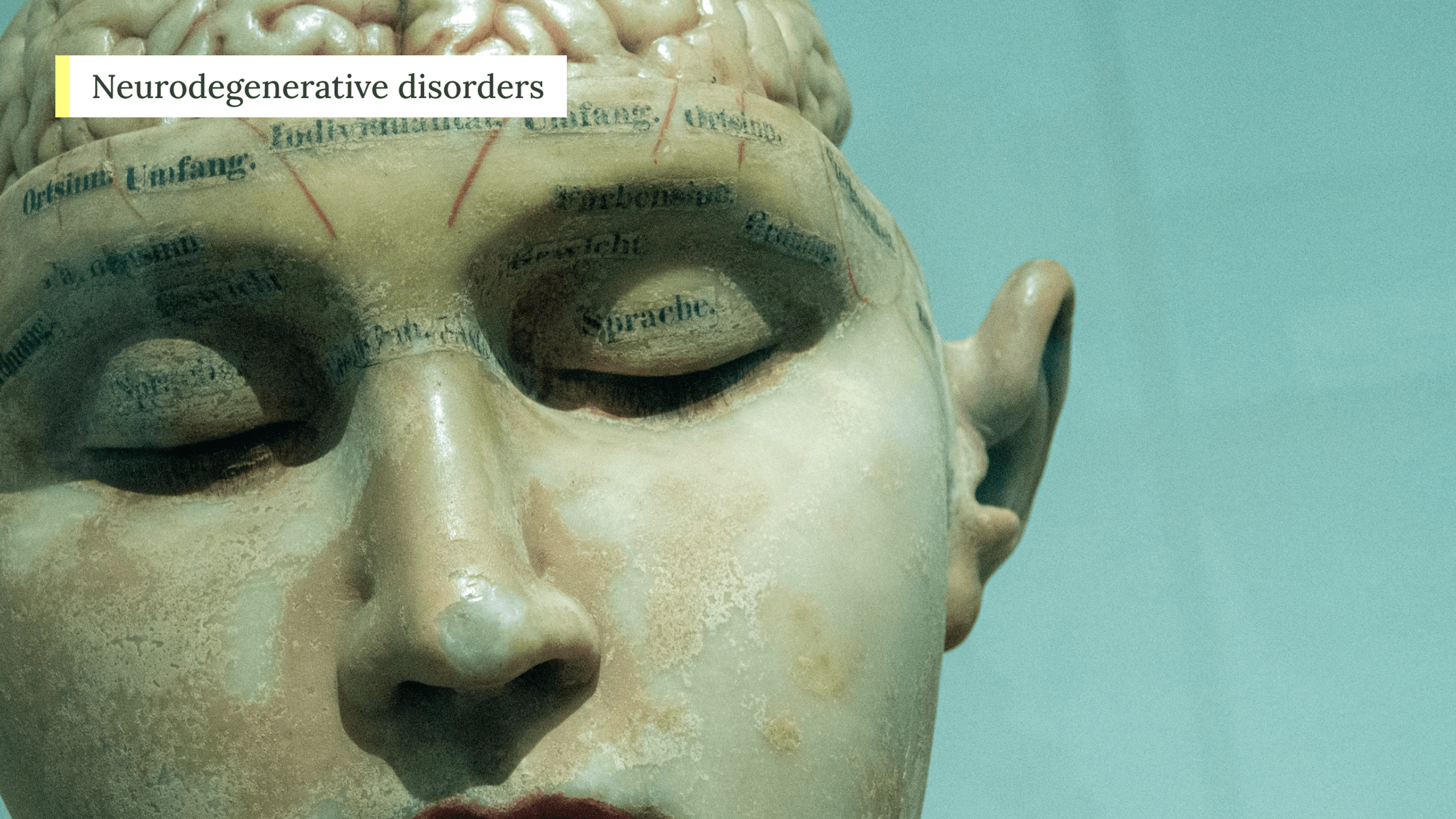 NeuroX1 concept 2