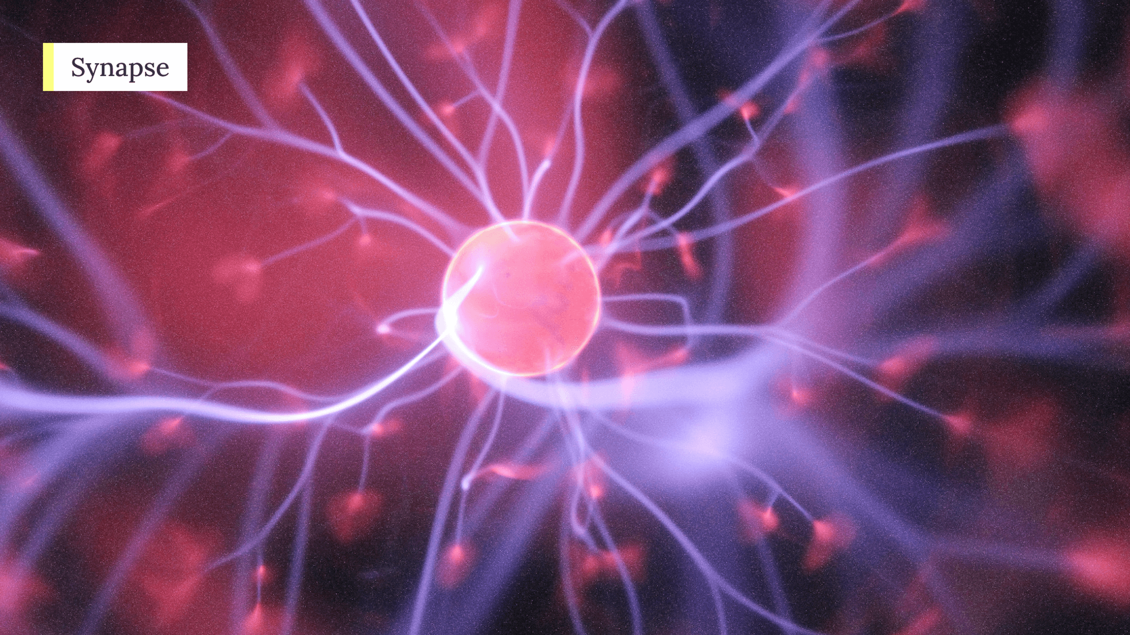 NeuroX1 concept 1