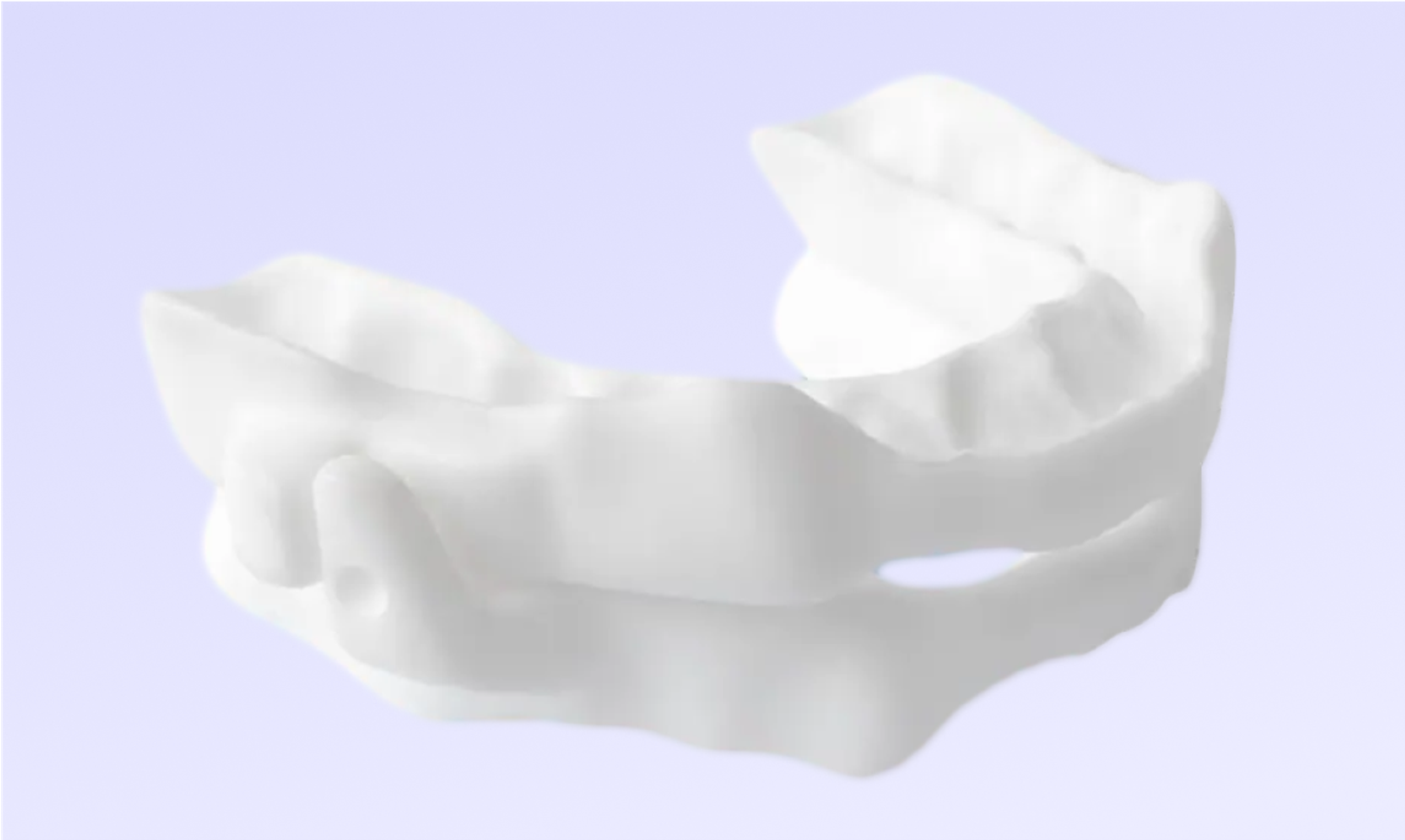 675743ca591e7163a43f1362_dental-appliance-1.png