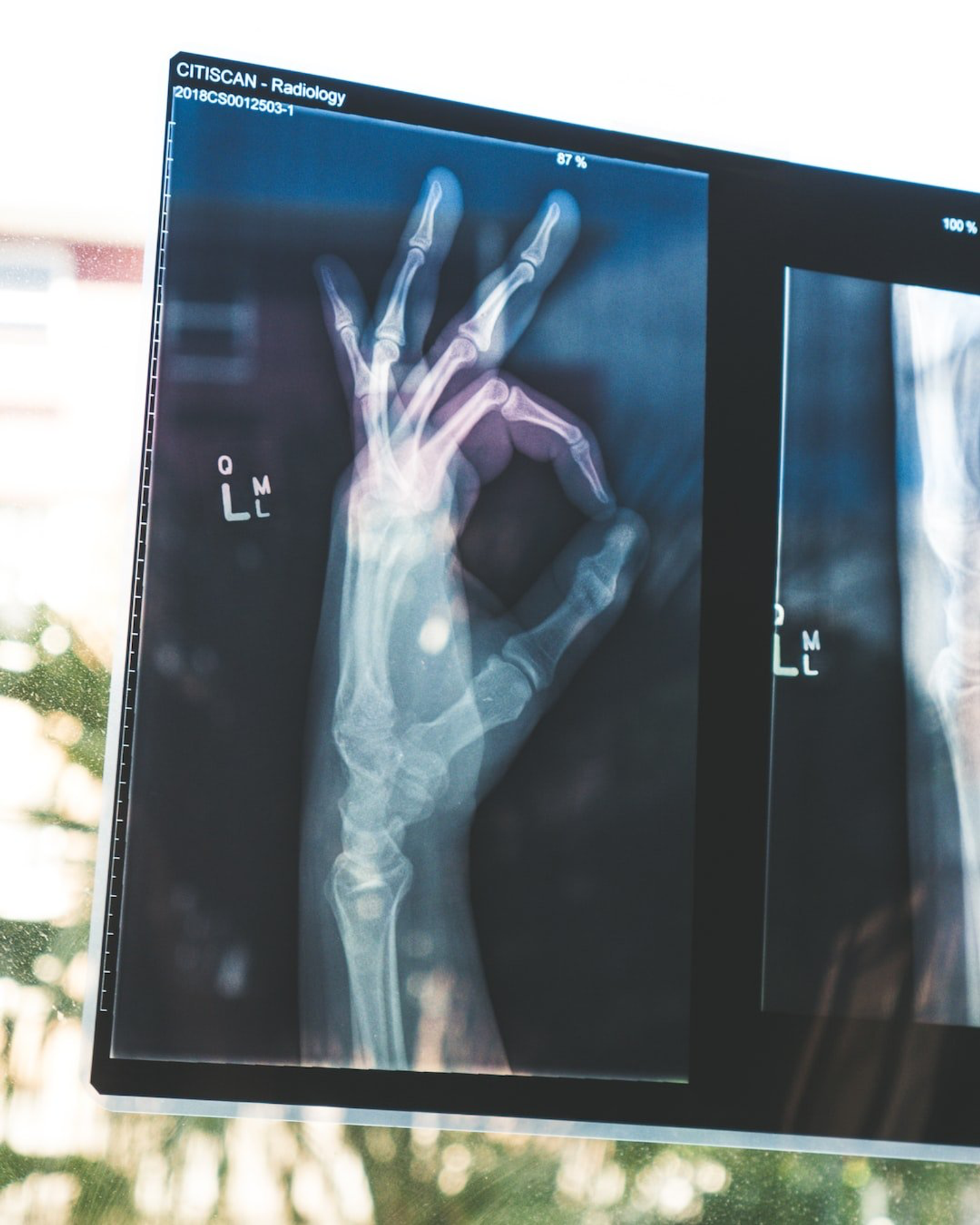 HOW THE HEALTHCARE INDUSTRY CAN LEVERAGE METAVERSE?
