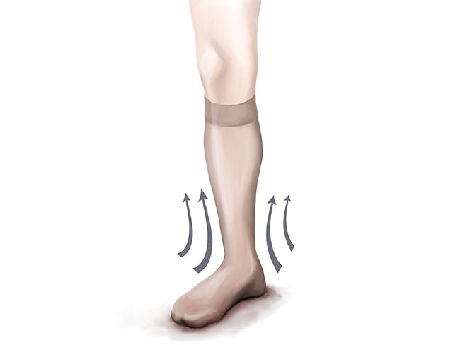 compression therapy