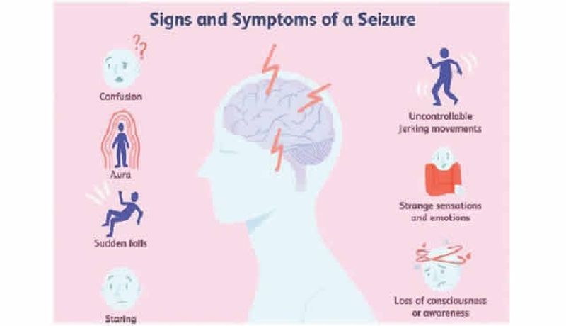 AI tool helps researchers treat child epilepsy