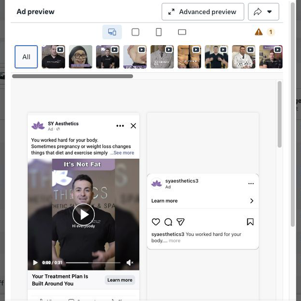 The live SY Aesthetics Mommy Makeover Meta ad in Ads Manager