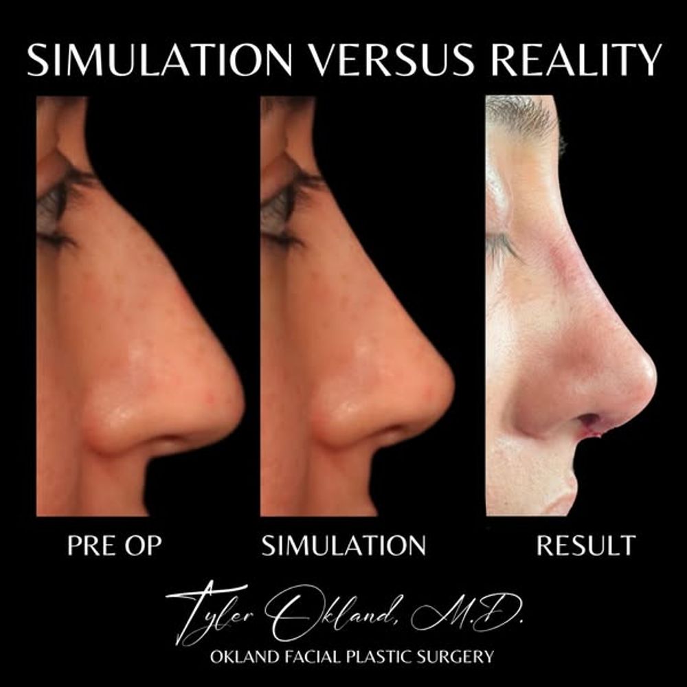 Original Okland Facial Plastic Surgery Meta ad