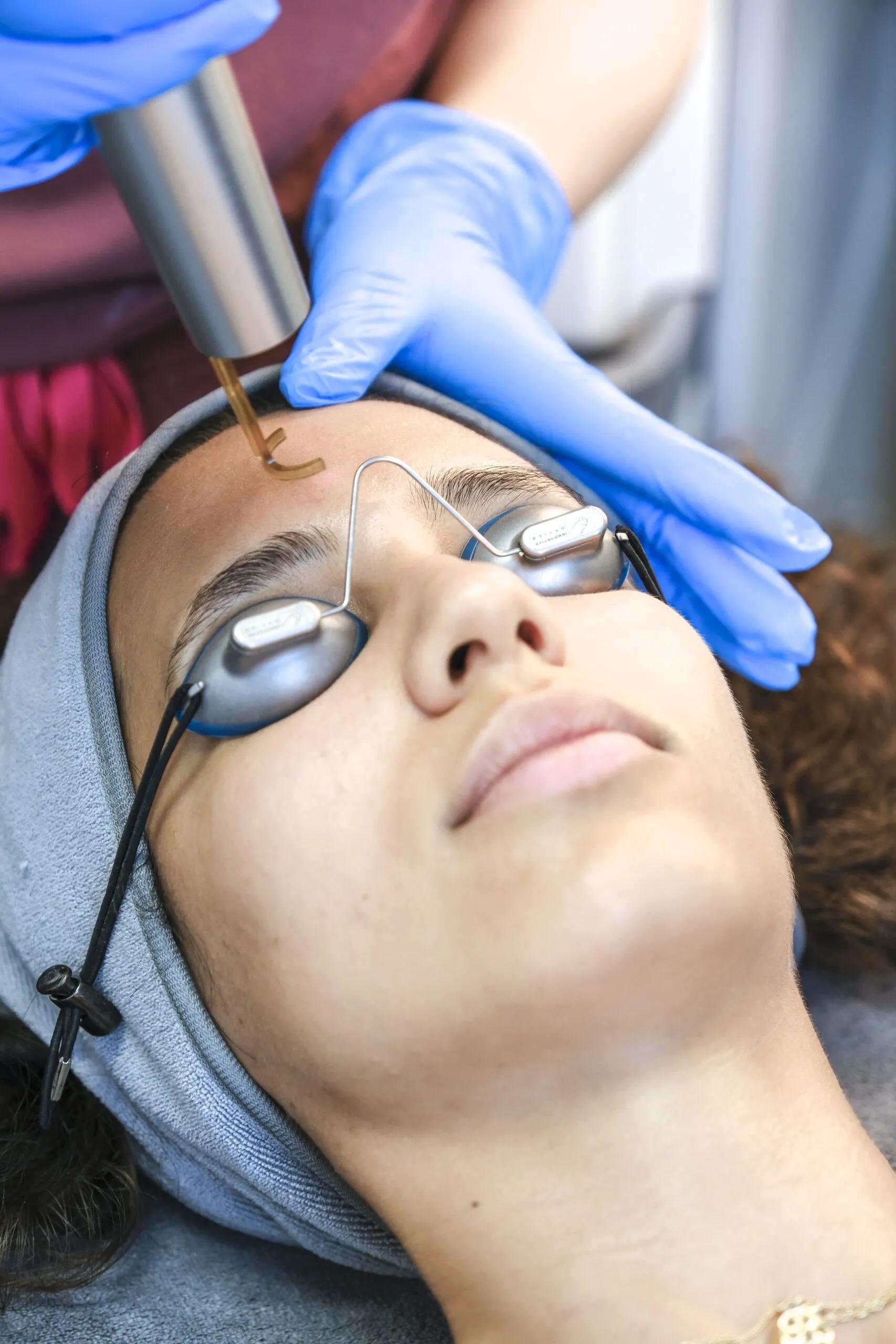 Laser skin therapy session