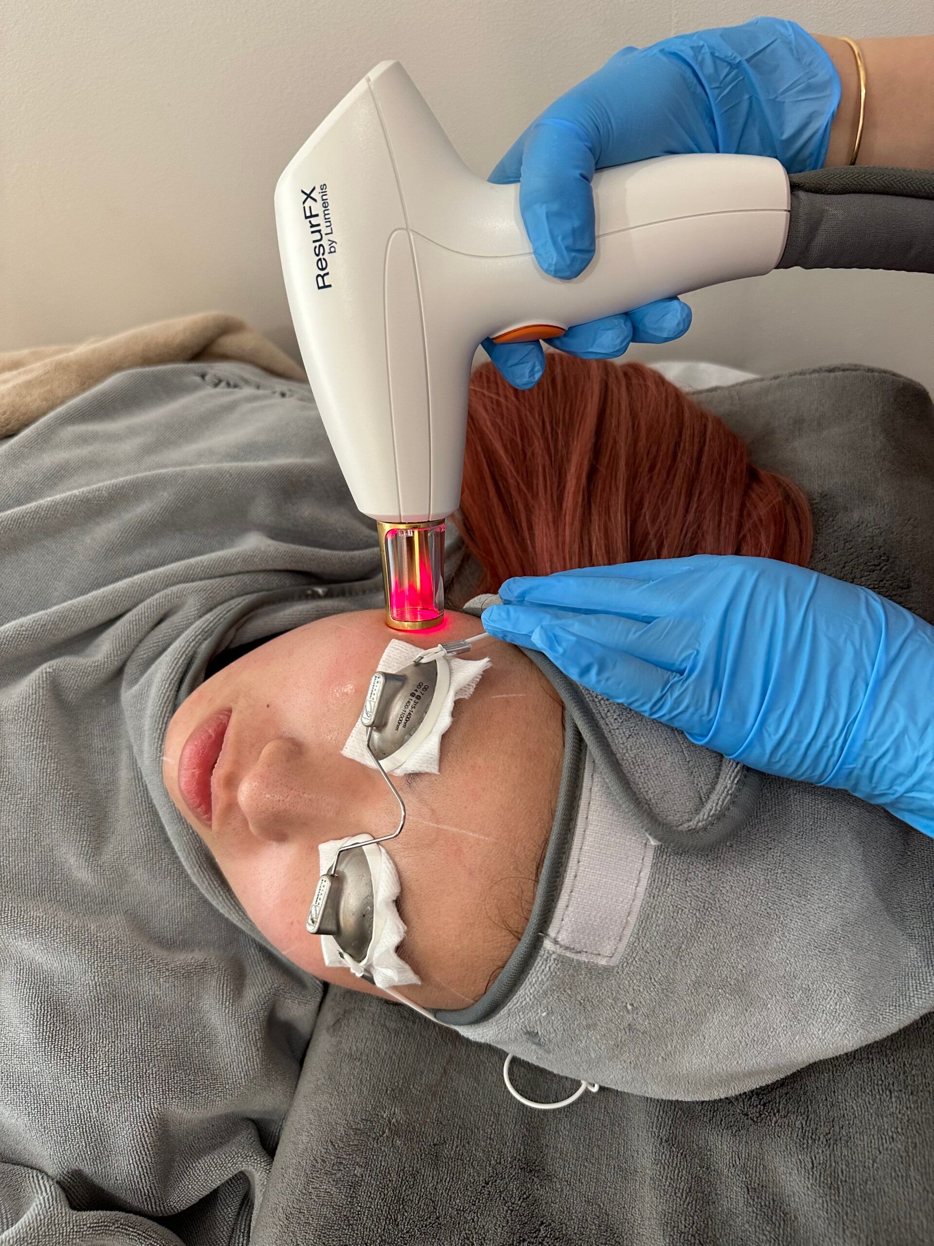 ResurFX after results