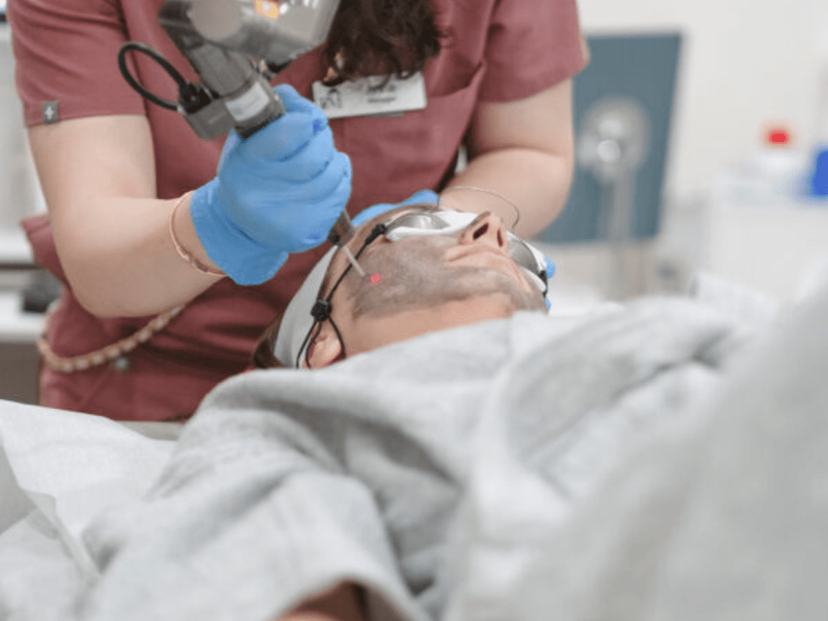 Spectra laser warming the carbon mask