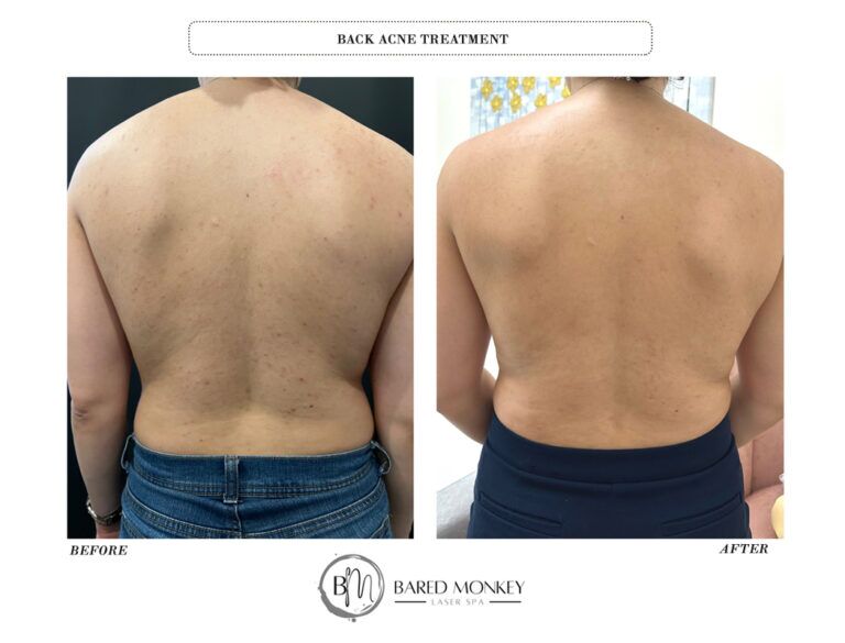 Skin rejuvenation result 24