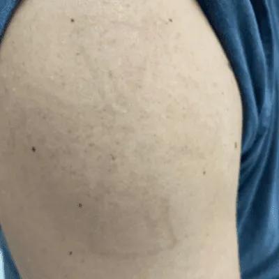 After tattoo healing