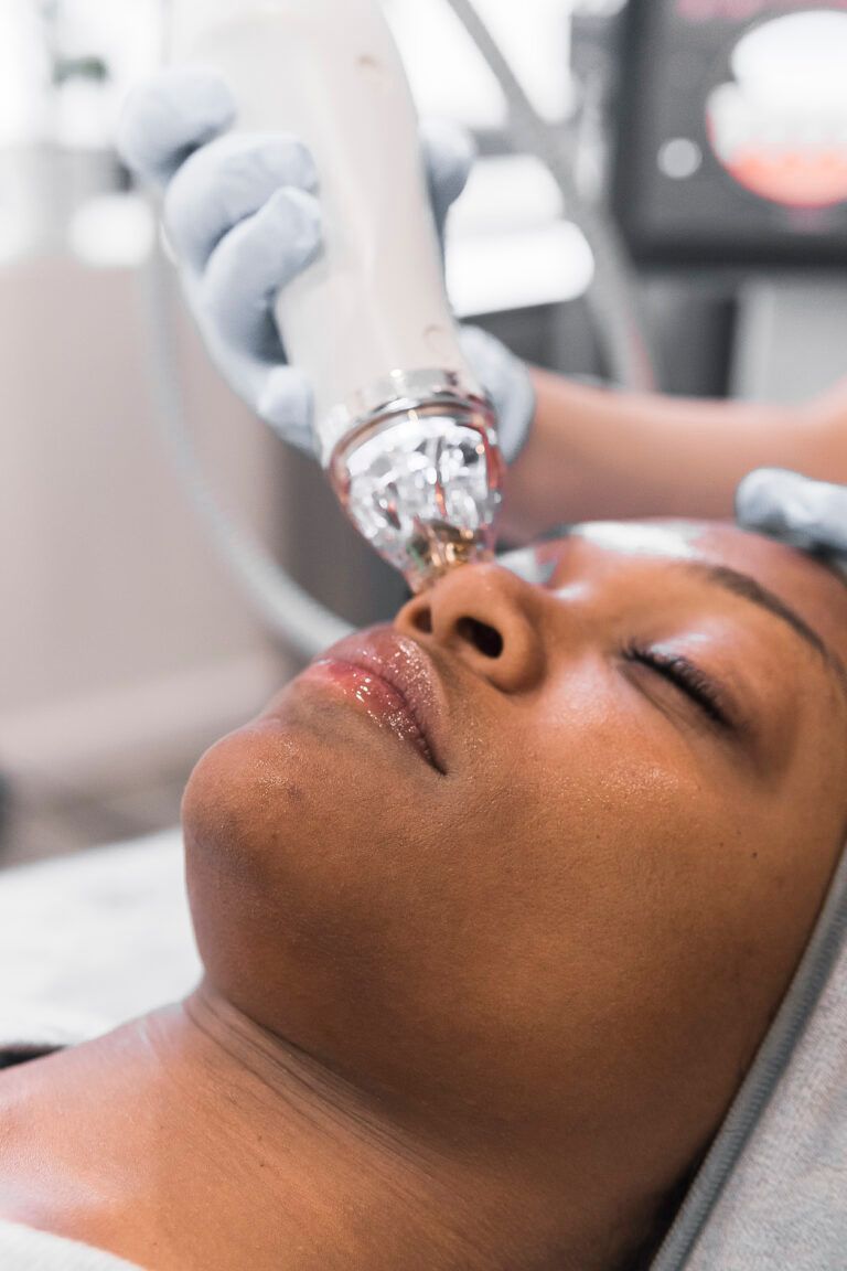 Microneedling results