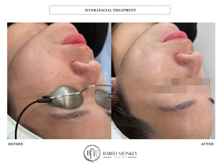 Skin rejuvenation result 28