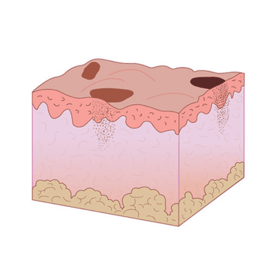 Before skin tone refinement