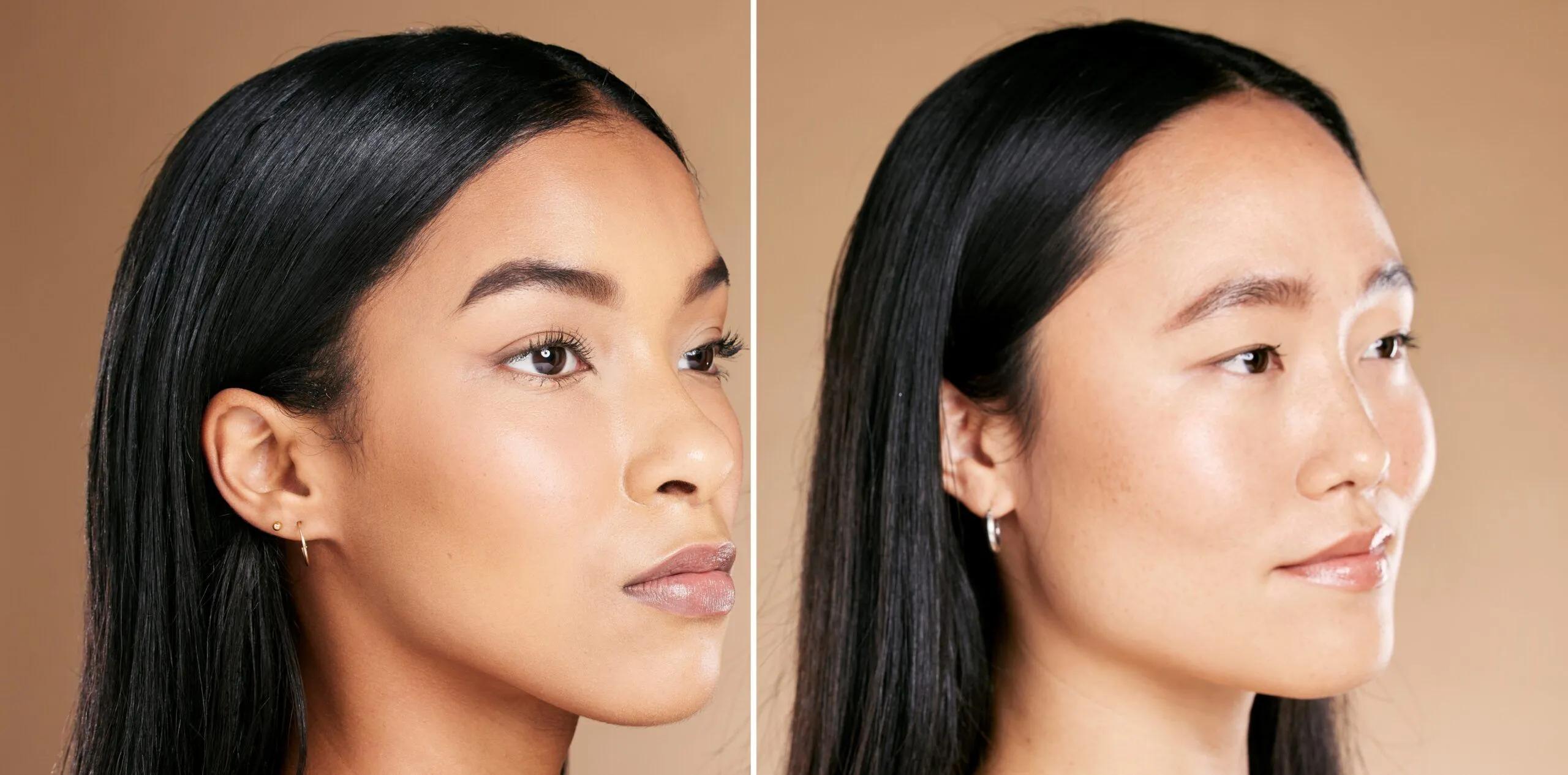 Acne and pigmentation treatment model