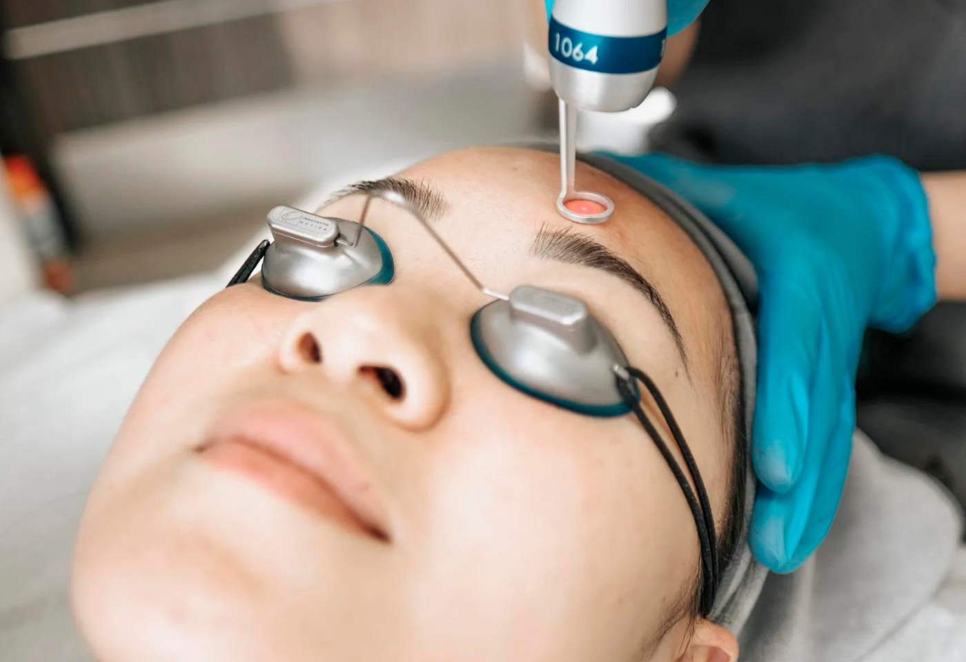 PicoWay before and after