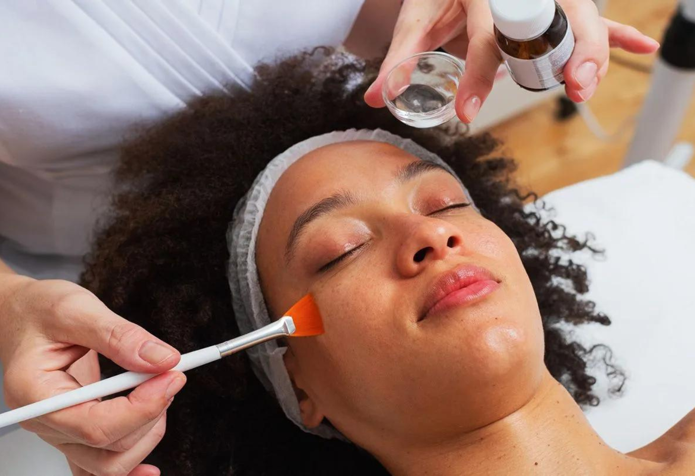 Chemical peel treatment