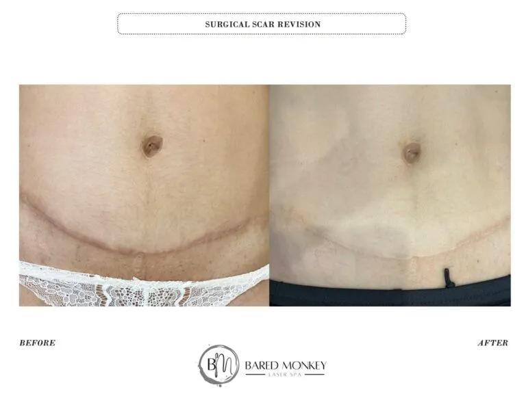 Skin rejuvenation result 44