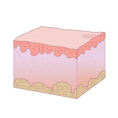 After skin tone refinement