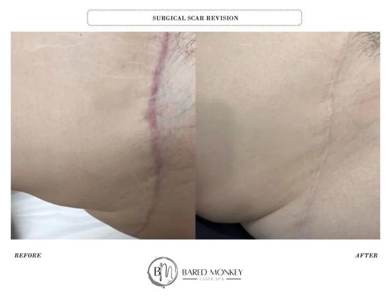 Skin rejuvenation result 45