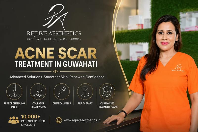 Acne Scar Treatment in Guwahati at Rejuve Aesthetics using RF Microneedling, CO2 Laser and advanced skin resurfacing treatments.