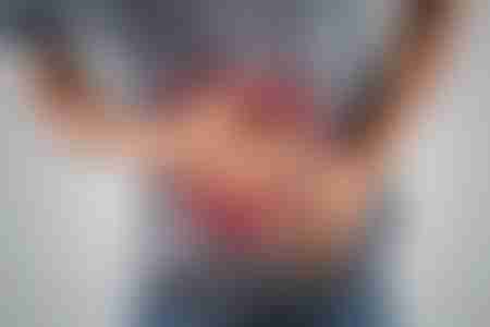 Abdominal Pain Colorectal Cancer Symptom