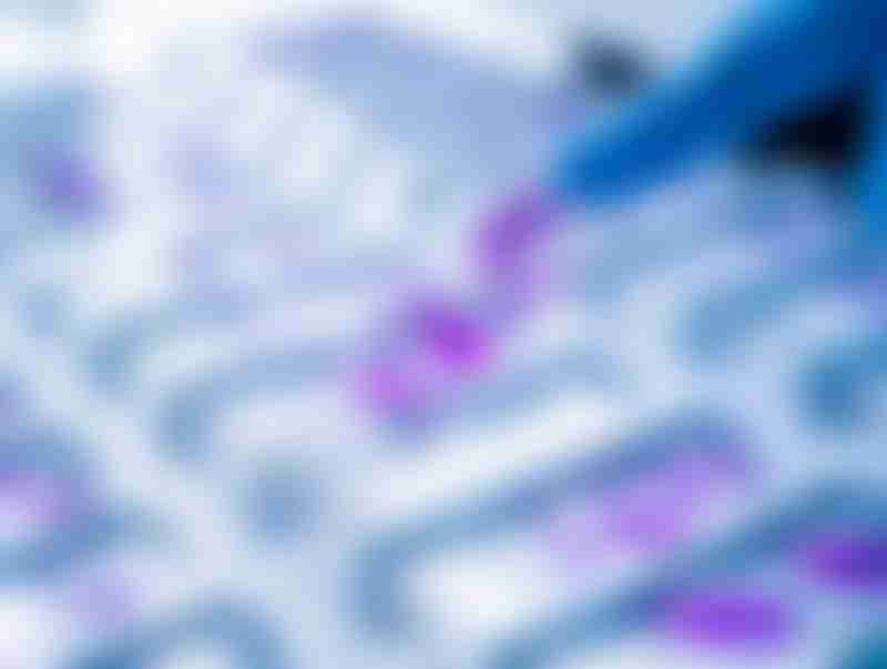 Biomarker Histological Tissue Sample