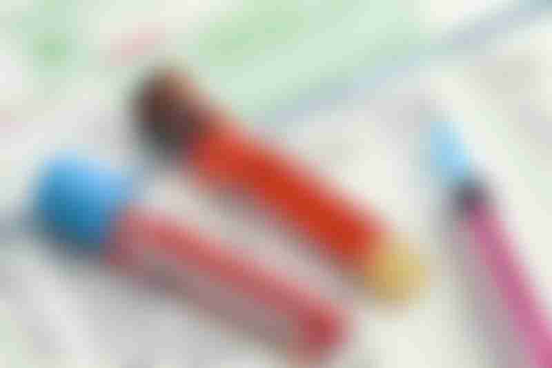 Blood Test Serum Marker