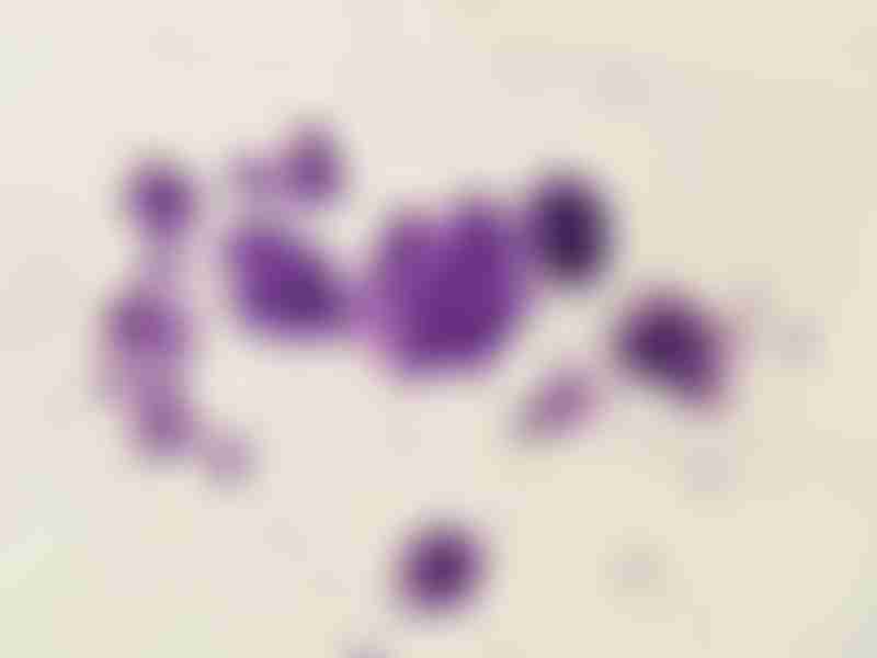 cancer image