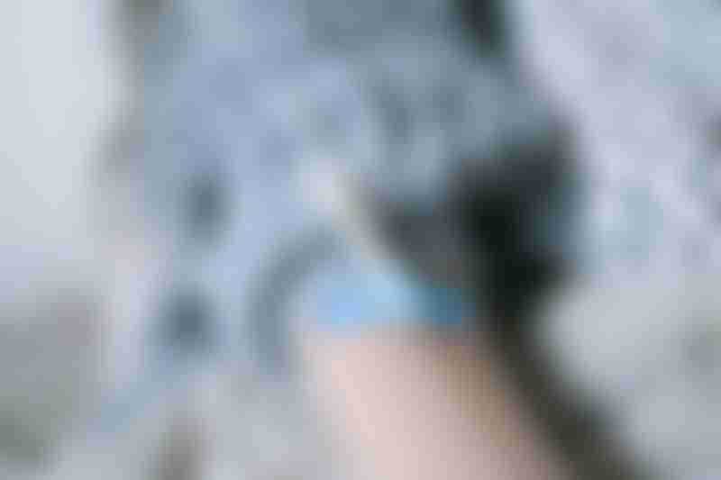 IV Plug on Arm
