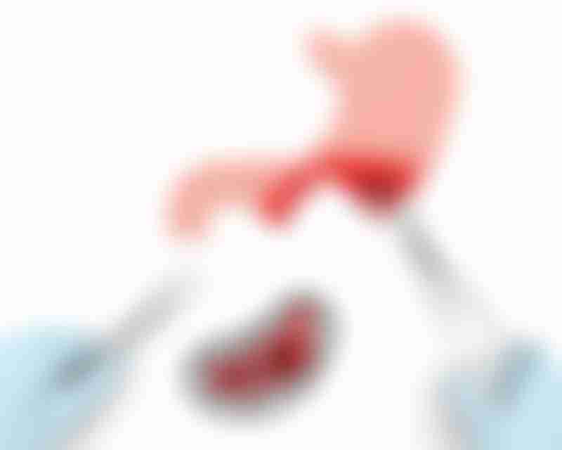 Puzzle Depicting Stomach Cancer Treatment